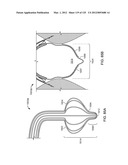 Reconfiguring Heart Features diagram and image