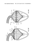 Reconfiguring Heart Features diagram and image