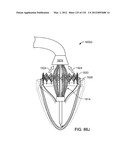 Reconfiguring Heart Features diagram and image