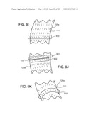 Reconfiguring Heart Features diagram and image