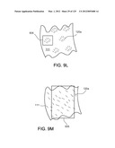 Reconfiguring Heart Features diagram and image