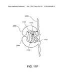 Reconfiguring Heart Features diagram and image