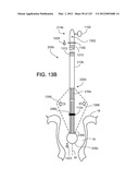 Reconfiguring Heart Features diagram and image