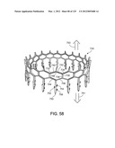 Reconfiguring Heart Features diagram and image