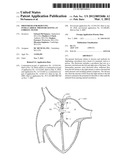 PROSTHESIS FOR REDUCING INTRA-CARDIAC PRESSURE HAVING AN EMBOLIC FILTER diagram and image