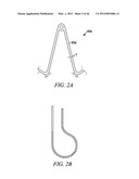 PROSTHESIS FOR REDUCING INTRA-CARDIAC PRESSURE HAVING AN EMBOLIC FILTER diagram and image