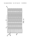 PROSTHESIS FOR REDUCING INTRA-CARDIAC PRESSURE HAVING AN EMBOLIC FILTER diagram and image