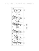 PROSTHESIS FOR REDUCING INTRA-CARDIAC PRESSURE HAVING AN EMBOLIC FILTER diagram and image