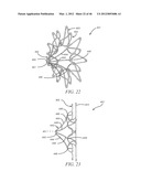 PROSTHESIS FOR REDUCING INTRA-CARDIAC PRESSURE HAVING AN EMBOLIC FILTER diagram and image