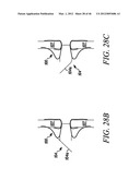 PROSTHESIS FOR REDUCING INTRA-CARDIAC PRESSURE HAVING AN EMBOLIC FILTER diagram and image