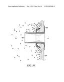 PROSTHESIS FOR REDUCING INTRA-CARDIAC PRESSURE HAVING AN EMBOLIC FILTER diagram and image