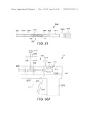 PROSTHESIS FOR REDUCING INTRA-CARDIAC PRESSURE HAVING AN EMBOLIC FILTER diagram and image