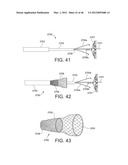 PROSTHESIS FOR REDUCING INTRA-CARDIAC PRESSURE HAVING AN EMBOLIC FILTER diagram and image