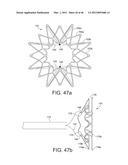 PROSTHESIS FOR REDUCING INTRA-CARDIAC PRESSURE HAVING AN EMBOLIC FILTER diagram and image