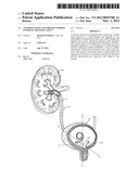 Anti-Refluxive and Trigone Sparing Internal Ureteral Stent diagram and image