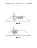 Anti-Refluxive and Trigone Sparing Internal Ureteral Stent diagram and image