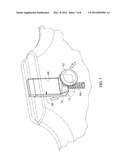 SIDE RAIL WITH TWO POSITION STORAGE FEATURE diagram and image