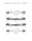 ORAL HYGIENE IMPLEMENT AND METHOD OF USE diagram and image