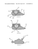 ORAL HYGIENE IMPLEMENT AND METHOD OF USE diagram and image