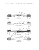 ORAL HYGIENE IMPLEMENT AND METHOD OF USE diagram and image