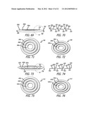 SCRUBBING RAZOR diagram and image