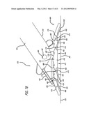 SCRUBBING RAZOR diagram and image