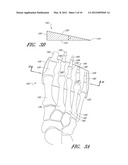 ORTHOTIC DEVICES diagram and image