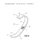 METHOD AND APPRATUS FOR APPLYING MIRROR-PRINTED FILM TO A PROSTHETIC OR     ORTHOTIC DEVICE AND DEVICE HAVING THE SAME diagram and image