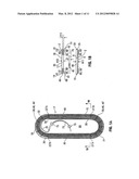 Suture Packaging diagram and image