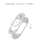 Suture Packaging diagram and image