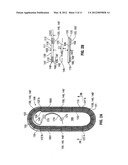 Suture Packaging diagram and image