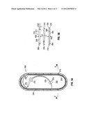 Suture Packaging diagram and image