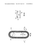 Suture Packaging diagram and image