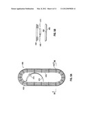 Suture Packaging diagram and image