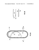 Suture Packaging diagram and image