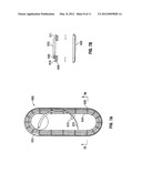 Suture Packaging diagram and image