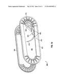 Suture Packaging diagram and image