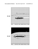 MULTICOMPONENT SACRIFICIAL STRUCTURE diagram and image