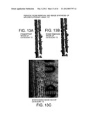 PATTERN NOISE REMOVAL DEVICE, PATTERN NOISE REMOVAL METHOD, AND PATTERN     NOISE REMOVAL PROGRAM diagram and image