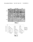 COMPOSITIONS AND METHODS FOR DIAGNOSING, TREATING, AND PREVENTING PROSTATE     CONDITIONS diagram and image