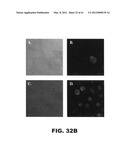 COMPOSITIONS AND METHODS FOR DIAGNOSING, TREATING, AND PREVENTING PROSTATE     CONDITIONS diagram and image