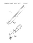 DENTAL INSTRUMENT AND METHOD OF USE diagram and image