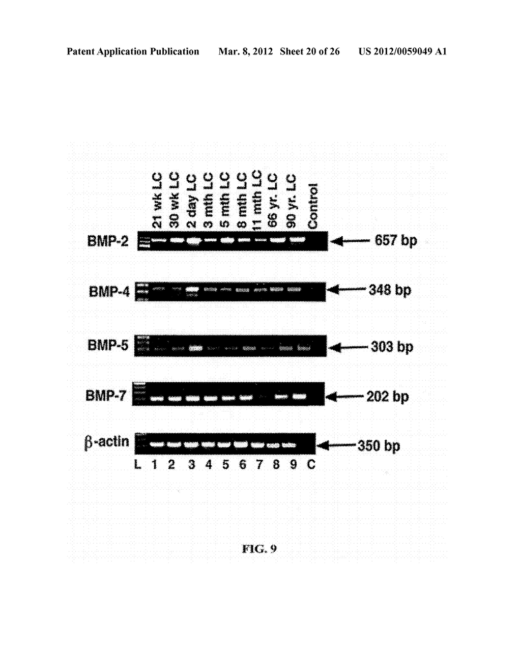 BONE MORPHOGENIC PROTEINS (BMP), BMP RECEPTORS AND BMP BINDING PROTEINS     AND THEIR USE IN THE DIAGNOSIS AND TREATMENT OF GLAUCOMA - diagram, schematic, and image 21