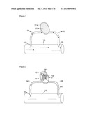 IMPLANTABLE DEVICE FOR REAL-TIME MONITORING OF GLYCEMIA AND DOSAGE diagram and image