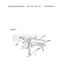 IMPLANTABLE DEVICE FOR REAL-TIME MONITORING OF GLYCEMIA AND DOSAGE diagram and image