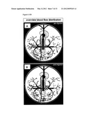 METHOD AND DEVICE FOR MONITORING AND IMPROVING ARTERIOGENESIS diagram and image