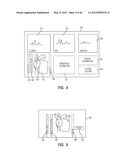 APPARATUS AND METHOD FOR CATHETER NAVIGATION USING ENDOVASCULAR ENERGY     MAPPING diagram and image