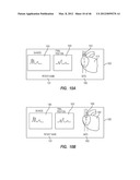 APPARATUS AND METHOD FOR CATHETER NAVIGATION USING ENDOVASCULAR ENERGY     MAPPING diagram and image