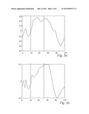 MEDICAL DEVICE AND METHOD FOR DETERMINING A DYSSYNCHRONICITY MEASURE     TECHNICAL FIELD diagram and image