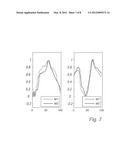 MEDICAL DEVICE AND METHOD FOR DETERMINING A DYSSYNCHRONICITY MEASURE     TECHNICAL FIELD diagram and image